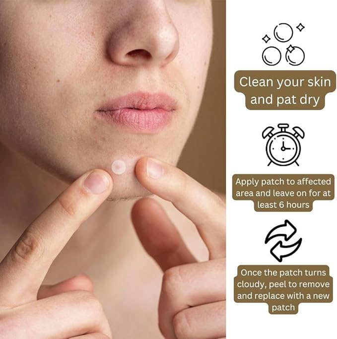 Derma V10 Spot Zapper Patches - To Promote Faster Healing